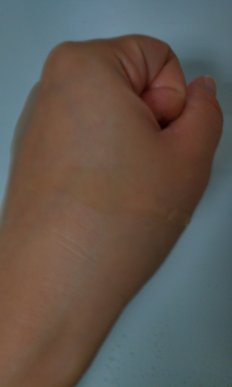 [____]stretch mark control__ _ tonic body treatment oil^^ - __